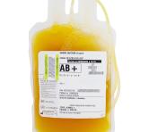 Sérum AB -8190_© EFS Tasky Orane